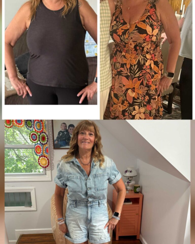 imgi_5_Thinnr-Before-After-5-BEFORE-AND-AFTER-768x1365